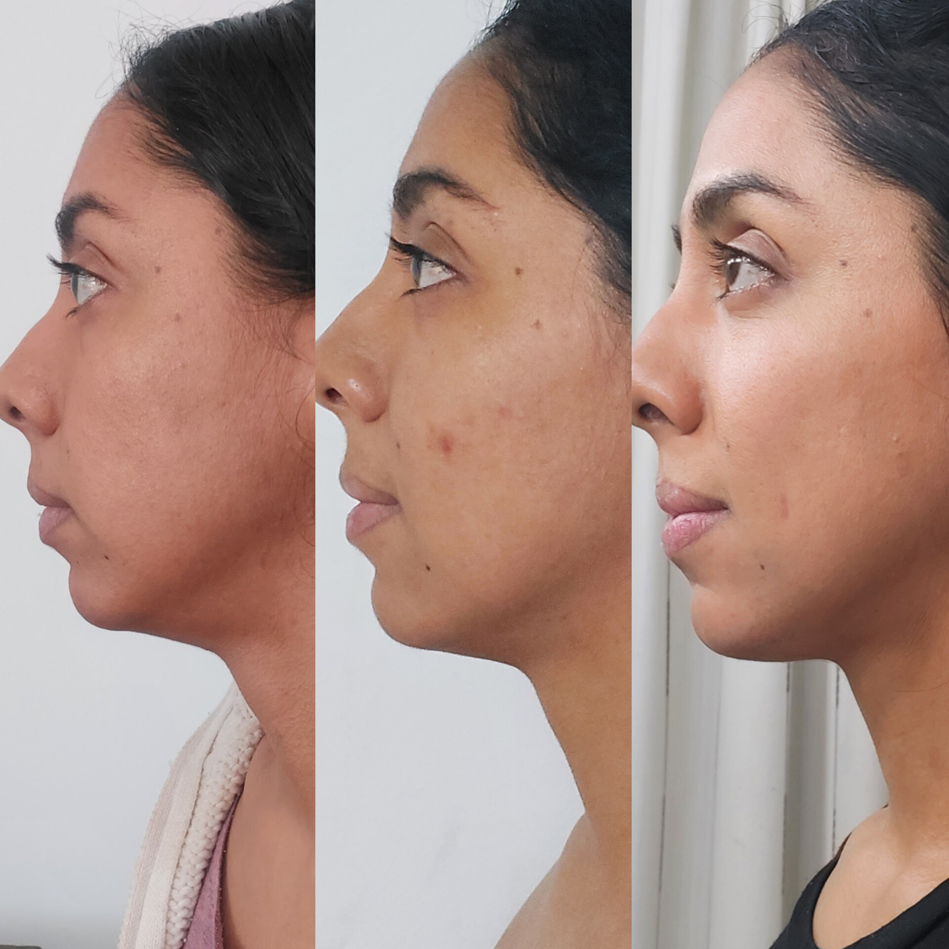 ¡Activa y Rejuvenece tu Rostro! – Prácticas Faciales